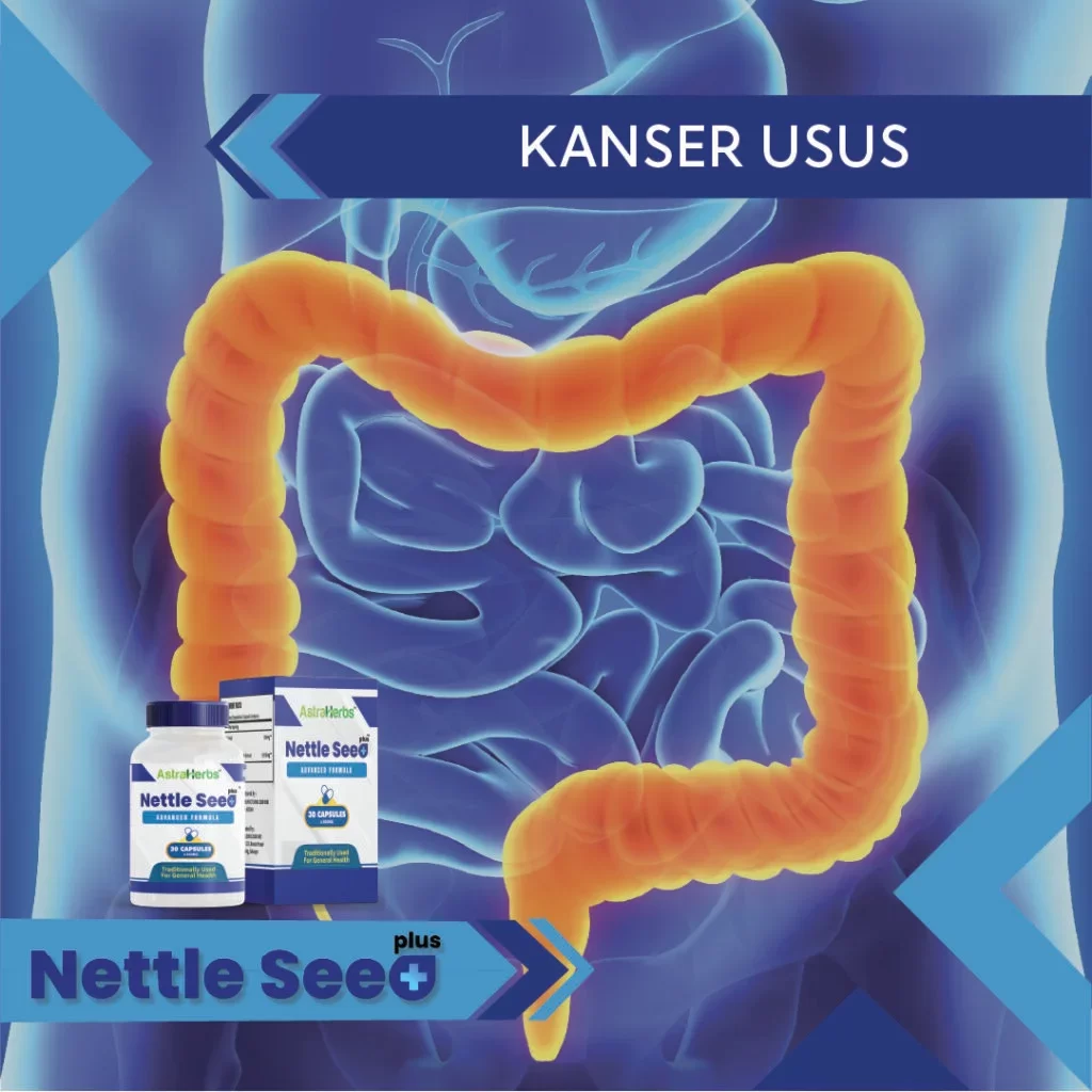 nettle seed plus kanser usus